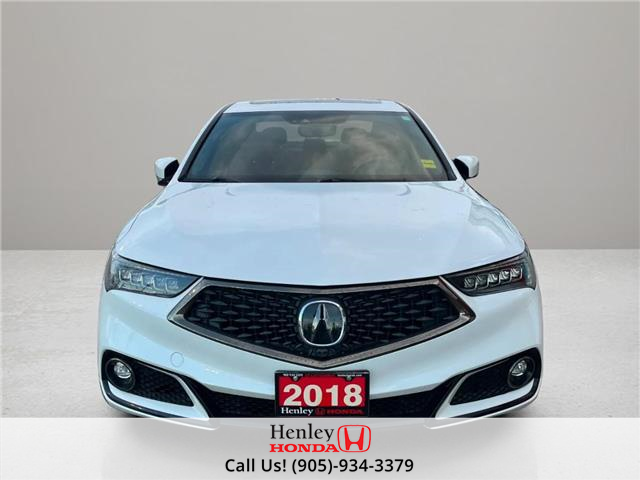 2018 Acura TLX Elite A-Spec (Stk: R12553) in St. Catharines - Image 3 of 12