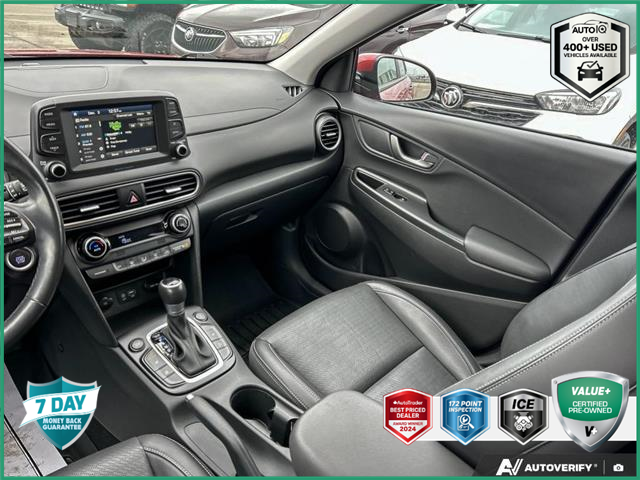 2020 Hyundai Kona 2.0L Luxury (Stk: R532A) in Grimsby - Image 24 of 24