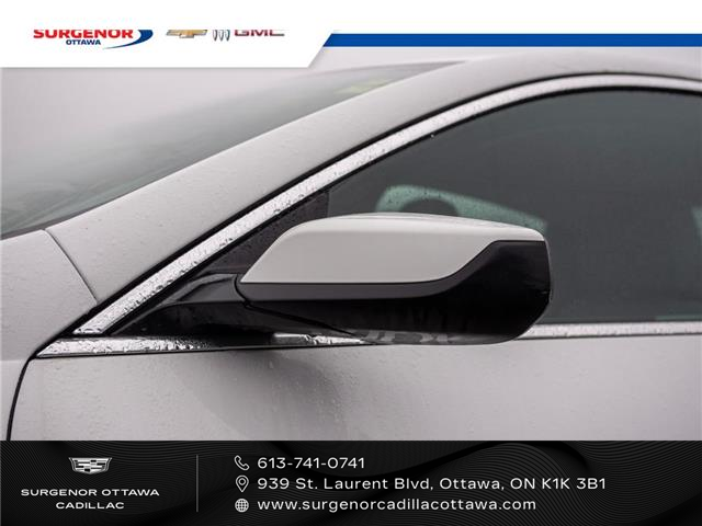 2024 Chevrolet Malibu 1LT (Stk: 25253A) in Ottawa - Image 3 of 23