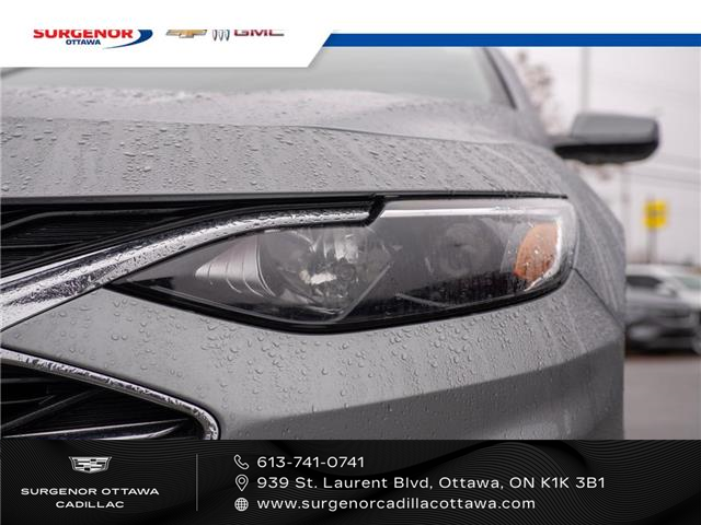2024 Chevrolet Malibu 1LT (Stk: 25252A) in Ottawa - Image 3 of 20