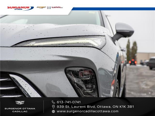 2024 Buick Envision Preferred (Stk: 25257A) in Ottawa - Image 3 of 24 2024 Buick Envision Preferred (Stk: 25257A) in Ottawa - Image 3 of 24