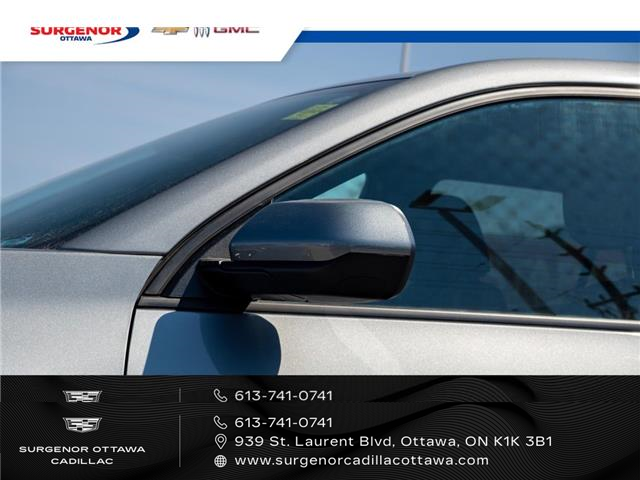 2026 Chevrolet Equinox LT (Stk: 26053A) in Ottawa - Image 4 of 20