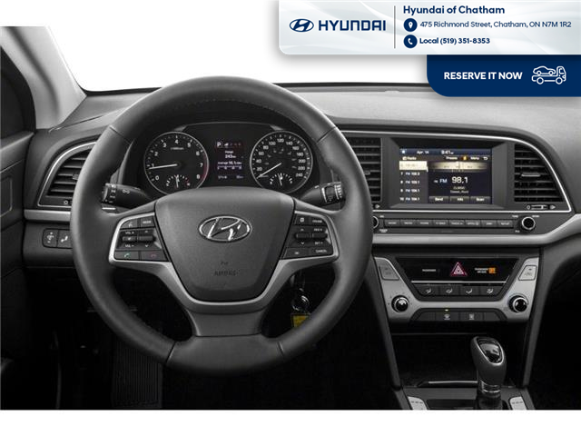 2017 Hyundai Elantra GLS (Stk: T150A) in Chatham - Image 4 of 11