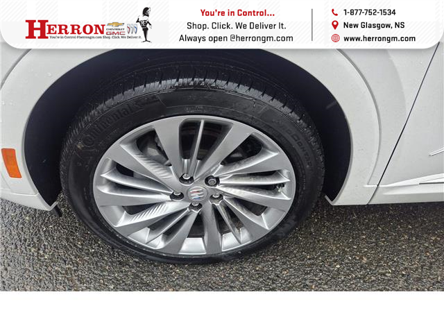 2024 Buick Envision Avenir (Stk: 35658A) in New Glasgow - Image 9 of 13