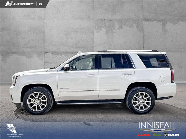 2017 GMC Yukon Denali (Stk: P1662) in Canmore - Image 3 of 27