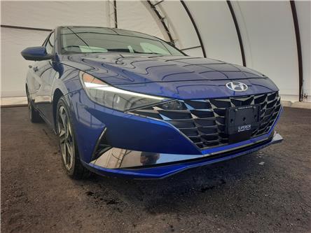 2021 Hyundai Elantra Ultimate (Stk: 18607A) in Thunder Bay - Image 1 of 17