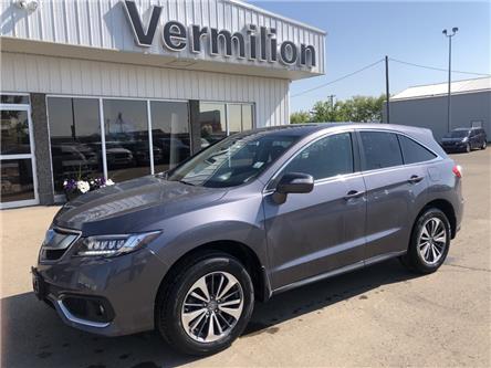 2018 Acura RDX Elite (Stk: VI2822) in Vermilion - Image 1 of 24