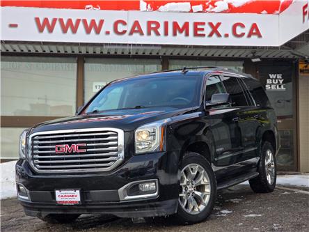 2017 GMC Yukon SLT (Stk: 2412603) in Waterloo - Image 1 of 35