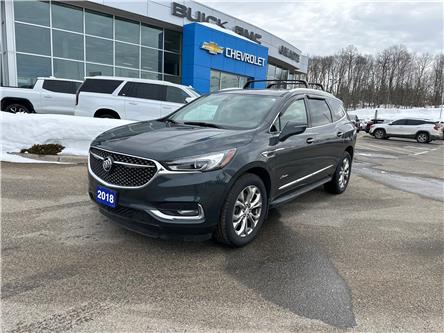 2018 Buick Enclave Avenir (Stk: 25207A) in Bracebridge - Image 1 of 18