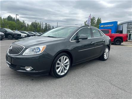 2016 Buick Verano Leather (Stk: 250344A) in Ottawa - Image 1 of 27