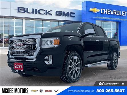 2022 GMC Canyon Denali (Stk: 25782) in Goderich - Image 1 of 27