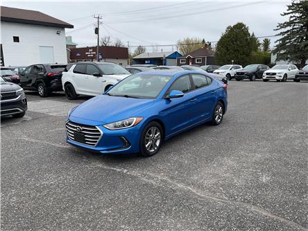 2018 Hyundai Elantra  (Stk: 251581A) in Ottawa Central - Image 1 of 33