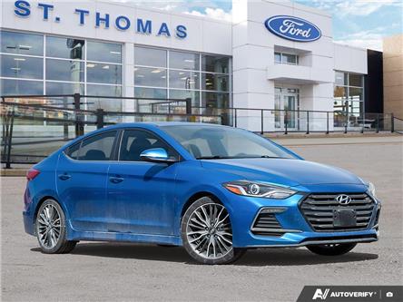 2017 Hyundai Elantra Sport (Stk: 6663A) in St. Thomas - Image 1 of 27 2017 Hyundai Elantra Sport (Stk: 6663A) in St. Thomas - Image 1 of 27