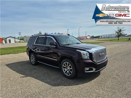 2017 GMC Yukon Denali (Stk: 45111A) in Fairview - Image 1 of 30