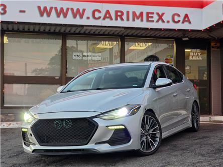 2017 Hyundai Elantra Sport Tech (Stk: 2606343) in Waterloo - Image 1 of 23