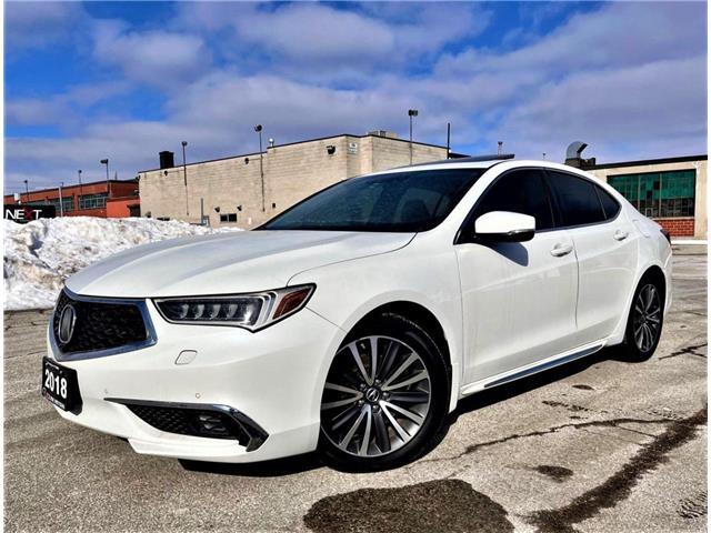 2018 Acura TLX Elite (Stk: 19UUB3) in Kitchener - Image 1 of 4