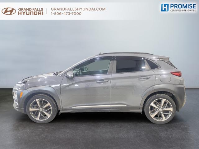 2021 Hyundai Kona 1.6T Trend (Stk: 240674NA) in Grand Falls - Image 5 of 15