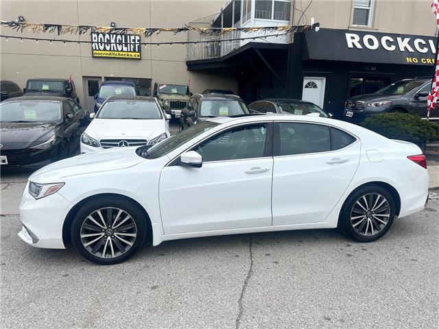 2018 Acura TLX Tech (Stk: A801155) in Scarborough - Image 2 of 18