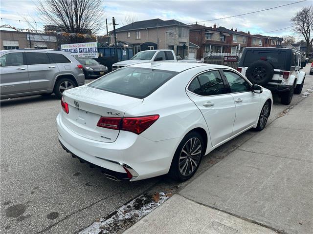 2018 Acura TLX Tech (Stk: A801155) in Scarborough - Image 5 of 18