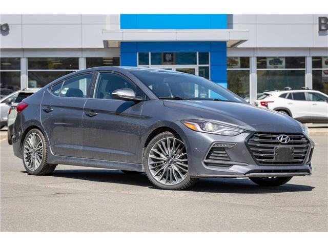 2017 Hyundai Elantra Sport (Stk: 5N195B) in Kamloops - Image 1 of 18