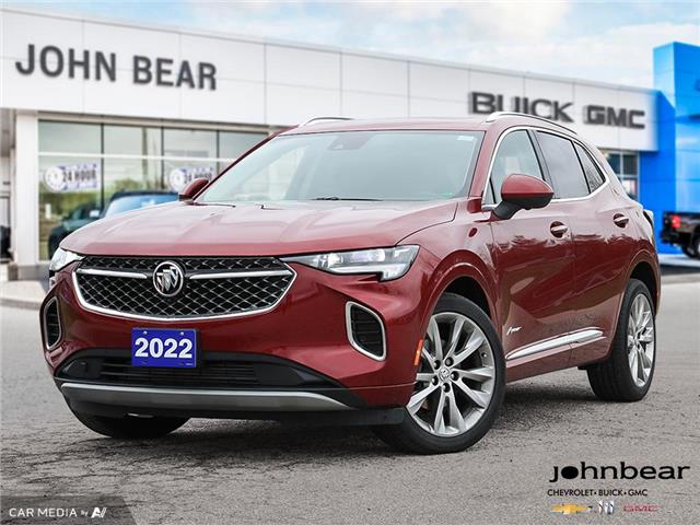 2022 Buick Envision Avenir (Stk: 924220) in New Hamburg - Image 1 of 31