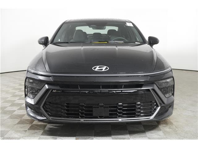 2025 Hyundai Sonata N-Line Ultimate (Stk: 16104418) in Markham - Image 2 of 23