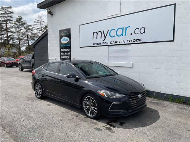 2018 Hyundai Elantra Sport (Stk: 250572) in Ottawa - Image 1 of 22