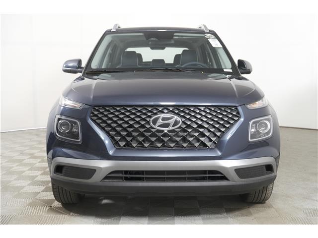 2025 Hyundai Venue Ultimate w/Denim Interior (IVT) (Stk: 16104449) in Markham - Image 2 of 19