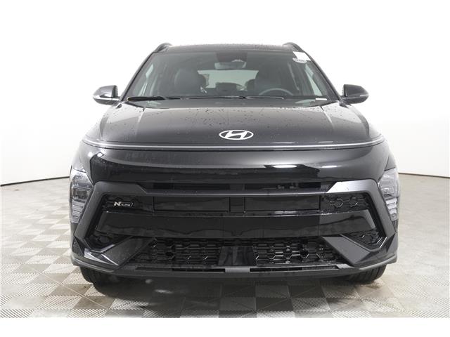 2025 Hyundai Kona 1.6T N Line (Stk: 16104488) in Markham - Image 2 of 20