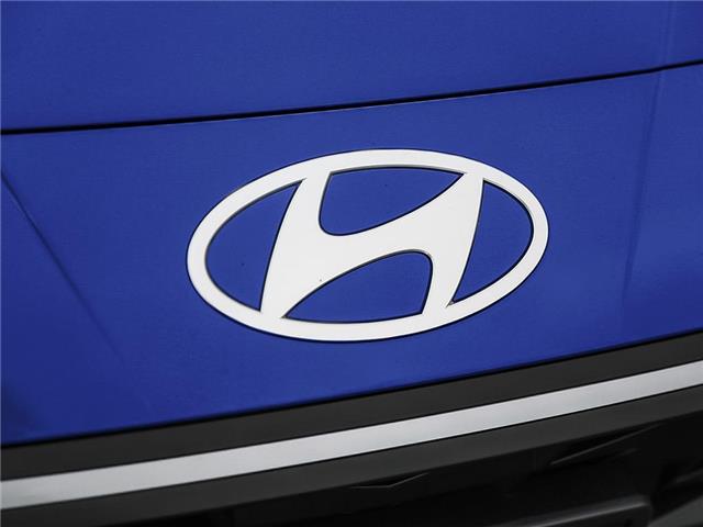 2025 Hyundai Elantra Preferred (Stk: 26T1467) in Aurora - Image 7 of 21