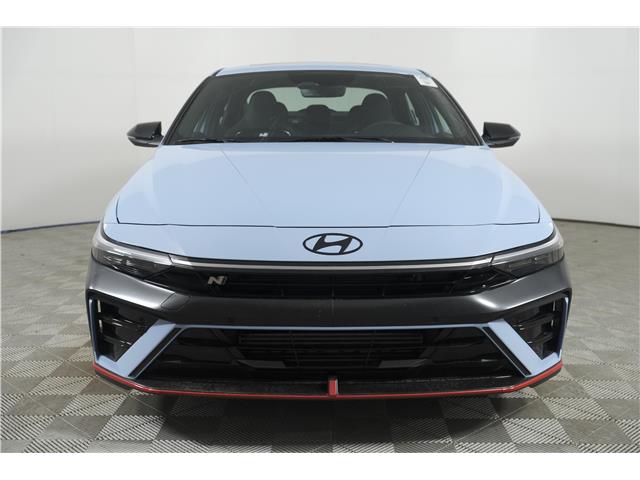 2025 Hyundai Elantra N Base (Stk: 16104651) in Markham - Image 2 of 31