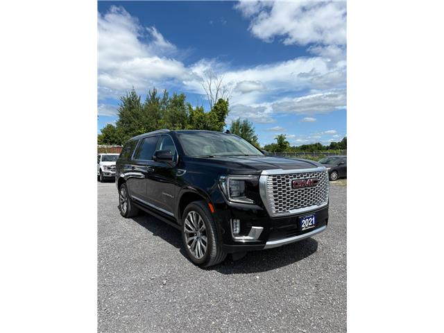 2021 GMC Yukon XL Denali (Stk: 1547) in Ottawa - Image 2 of 11