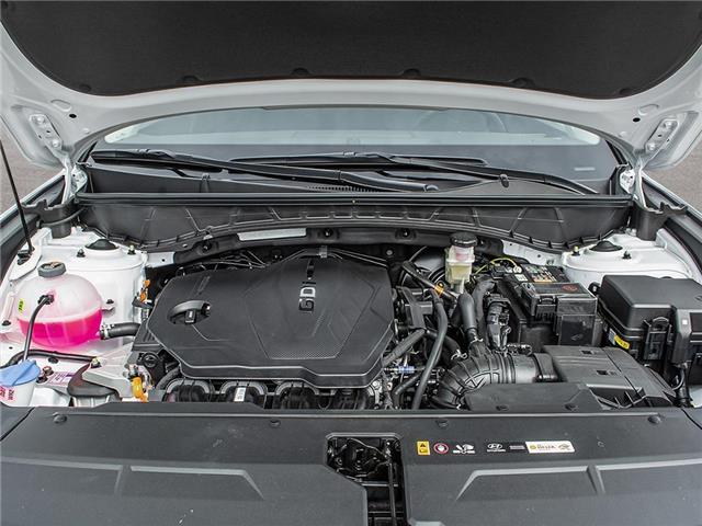 2025 Hyundai Tucson Preferred (Stk: 261598) in Aurora - Image 6 of 23
