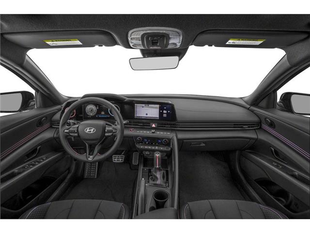 2025 Hyundai Elantra N Line Ultimate (Stk: 35407) in Scarborough - Image 5 of 12