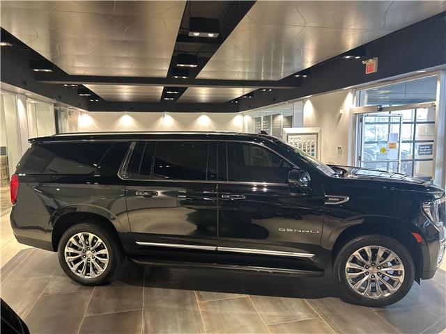 2024 GMC Yukon XL Denali (Stk: 34140A) in Scarborough - Image 6 of 18