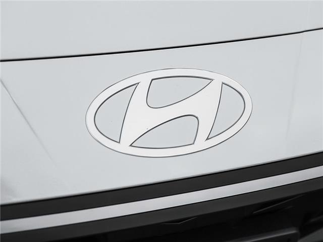 2025 Hyundai Elantra Preferred (Stk: 261718) in Aurora - Image 7 of 21