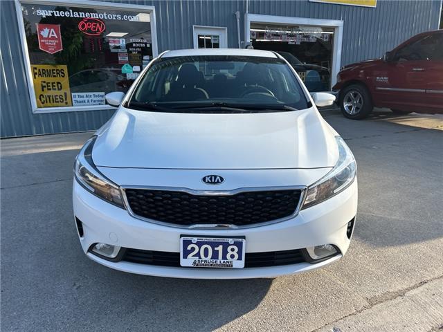 2018 Kia Forte LX+ (Stk: 38017) in Belmont - Image 3 of 18