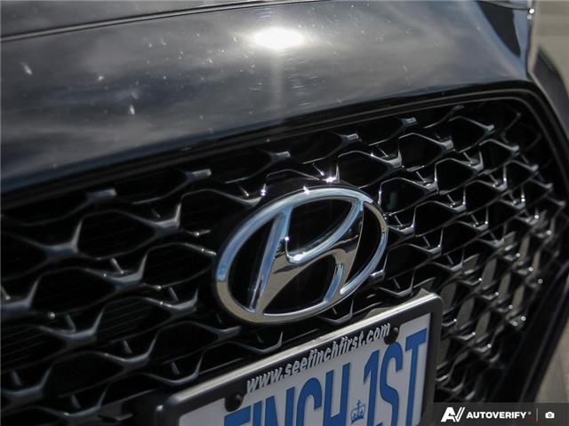 2022 Hyundai Veloster N N (Stk: 120145) in London - Image 8 of 25