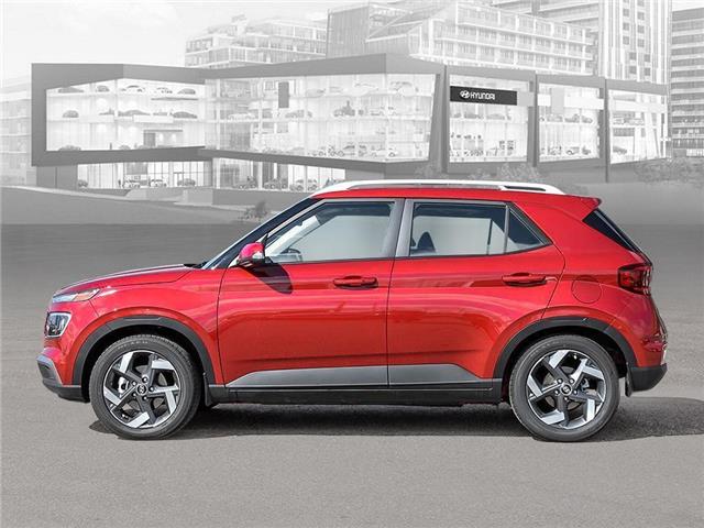 2025 Hyundai Venue  (Stk: 250208) in Toronto - Image 3 of 21