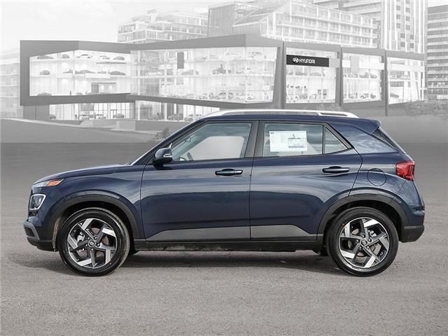 2025 Hyundai Venue Preferred (Stk: 250160) in Toronto - Image 3 of 22