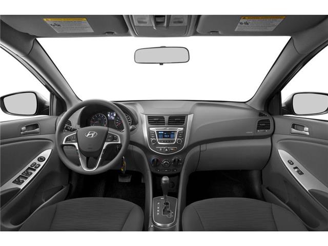 2017 Hyundai Accent SE (Stk: NI6298A) in Cranbrook - Image 5 of 11