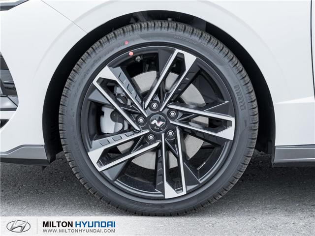 2025 Hyundai Sonata N-Line Ultimate (Stk: 498075) in Milton - Image 4 of 29