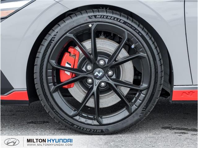 2025 Hyundai Elantra N Base (Stk: 034871) in Milton - Image 4 of 27
