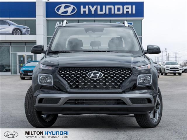 2025 Hyundai Venue Ultimate w/Black Interior (IVT) (Stk: 390505) in Milton - Image 2 of 25