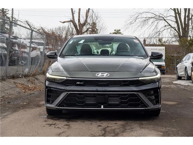 2025 Hyundai Elantra N Line Ultimate (Stk: S25272) in Ottawa - Image 5 of 28