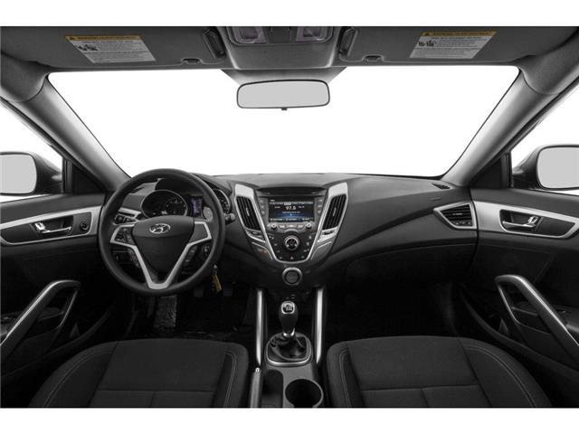 2016 Hyundai Veloster Tech (Stk: S390A) in Chatham - Image 3 of 9