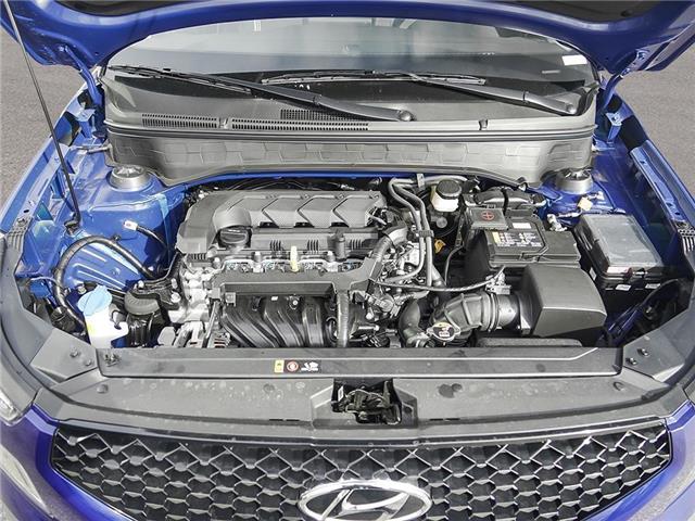 2026 Hyundai Venue Ultimate w/Black Interior (IVT) (Stk: 26122) in Toronto - Image 6 of 22