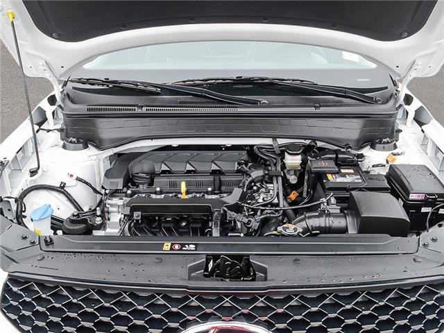 2026 Hyundai Venue Ultimate w/Black Interior (IVT) (Stk: 26090) in Toronto - Image 6 of 22