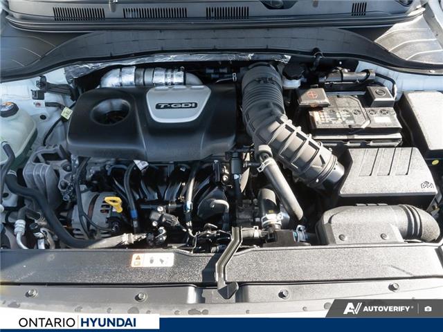 2021 Hyundai Kona 1.6T Urban Edition (Stk: 7-1349A) in Whitby - Image 6 of 27