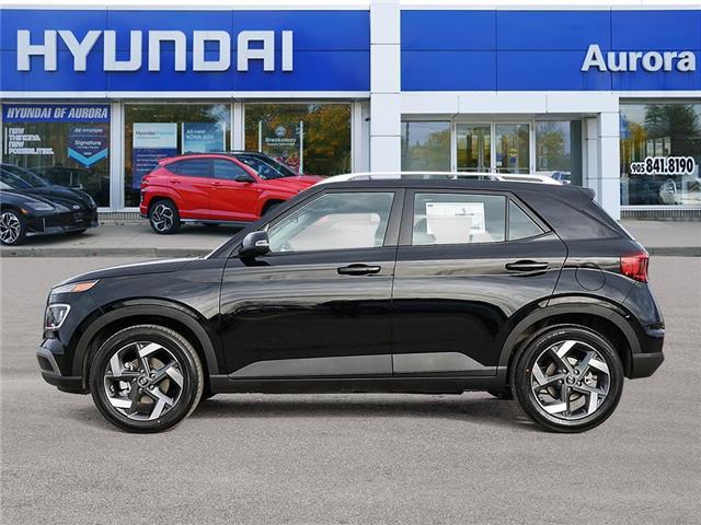 2026 Hyundai Venue Ultimate w/Black Interior (IVT) (Stk: 261796) in Aurora - Image 3 of 22